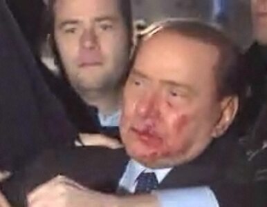 Miniatura: Zakrwawiony Berlusconi trafił do szpitala....
