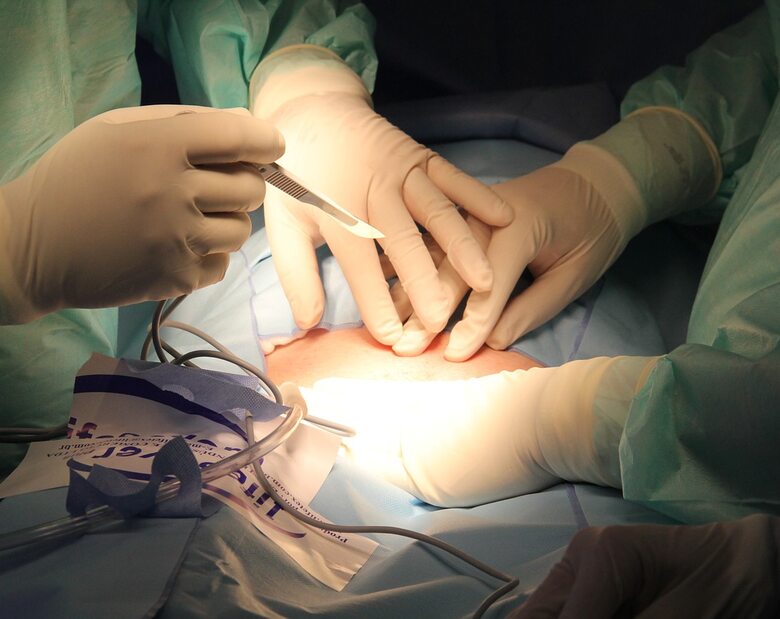 Miniatura: Kardiochirurg o przeszczepach: Remontujemy...