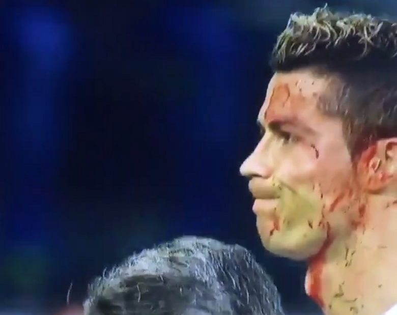 Miniatura: Ronaldo zalany krwią musiał zejść z...