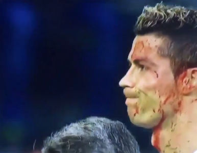 Miniatura: Ronaldo zalany krwią musiał zejść z...