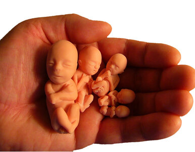 Miniatura: SLD: Pozywamy lekarza, który odmówił aborcji
